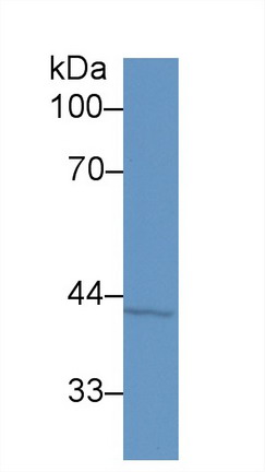 Polyclonal Antibody to Mammary Serine Protease Inhibitor (Maspin)