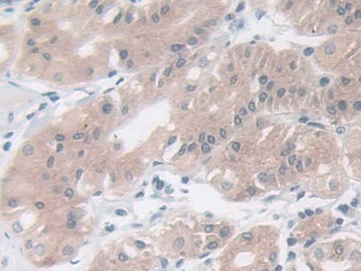 Polyclonal Antibody to Mammary Serine Protease Inhibitor (Maspin)