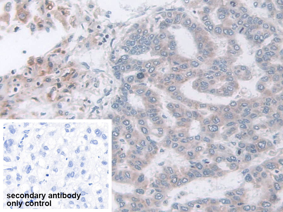 Polyclonal Antibody to Mammary Serine Protease Inhibitor (Maspin)