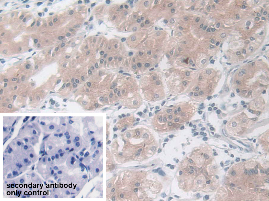 Polyclonal Antibody to Mammary Serine Protease Inhibitor (Maspin)