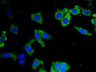 Polyclonal Antibody to Leukocyte Elastase Inhibitor (LEI)