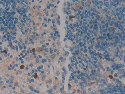 Polyclonal Antibody to Leukocyte Elastase Inhibitor (LEI)