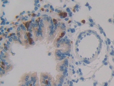 Polyclonal Antibody to Leukocyte Elastase Inhibitor (LEI)