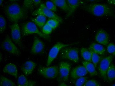 Polyclonal Antibody to Leukocyte Elastase Inhibitor (LEI)