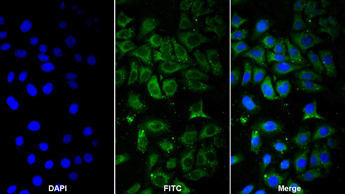 Polyclonal Antibody to Leukocyte Elastase Inhibitor (LEI)