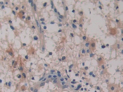 Polyclonal Antibody to Placental Thrombin Inhibitor (PTI)