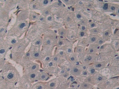 Polyclonal Antibody to Placental Thrombin Inhibitor (PTI)