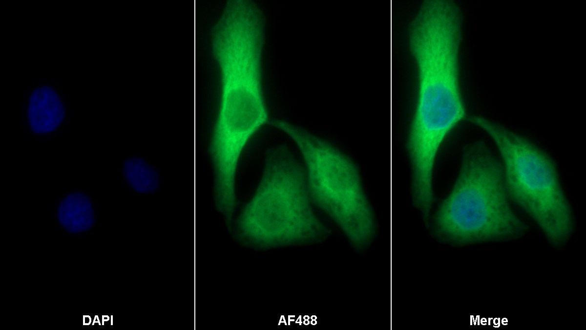 Polyclonal Antibody to Cytoplasmic Antiproteinase 3 (CAP3)