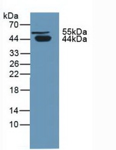 Polyclonal Antibody to Protein C Inhibitor (PCI)