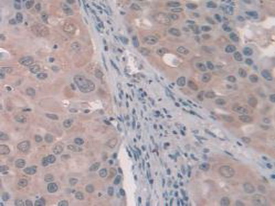 Polyclonal Antibody to Protein C Inhibitor (PCI)