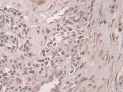 Polyclonal Antibody to Protein C Inhibitor (PCI)