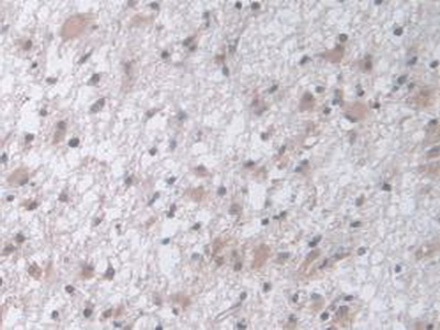 Polyclonal Antibody to Protein C Inhibitor (PCI)