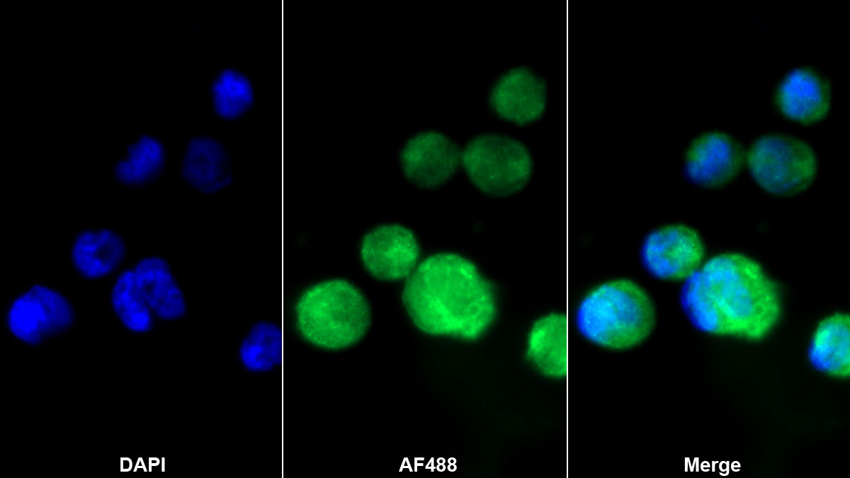 Polyclonal Antibody to Pronociceptin (PNOC)