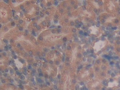 Polyclonal Antibody to Pronociceptin (PNOC)