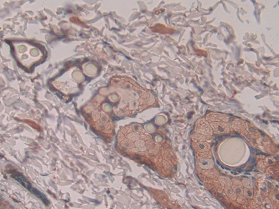 Polyclonal Antibody to Pronociceptin (PNOC)