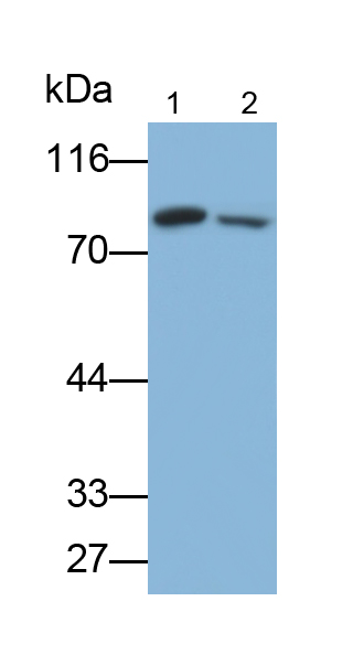 Polyclonal Antibody to Phosphofructokinase, Muscle (PFKM)