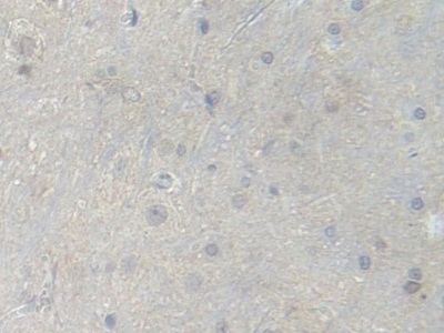 Polyclonal Antibody to Phosphofructokinase, Muscle (PFKM)