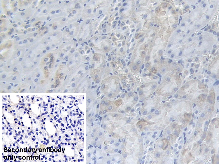 Polyclonal Antibody to Phosphofructokinase, Muscle (PFKM)