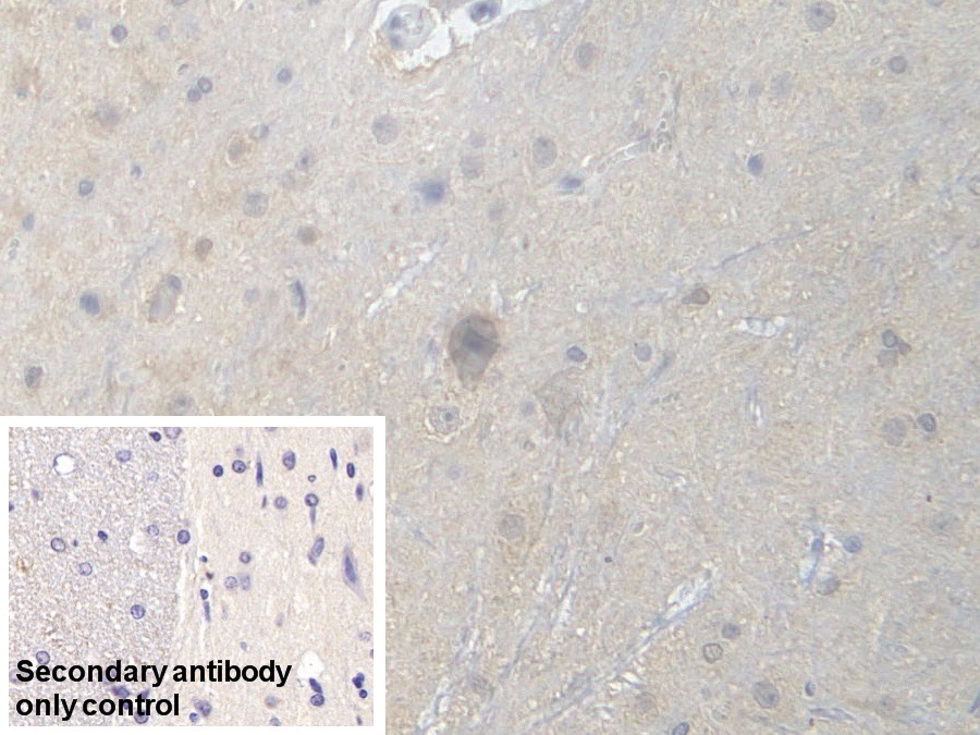 Polyclonal Antibody to Phosphofructokinase, Muscle (PFKM)