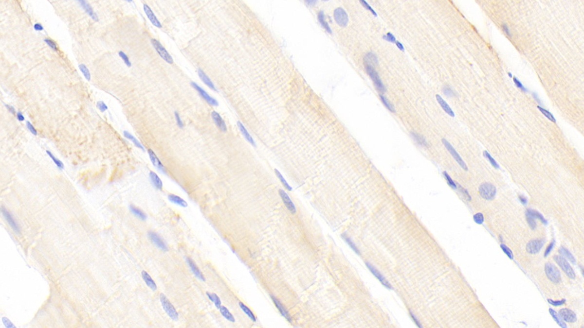 Polyclonal Antibody to Phosphofructokinase, Liver (PFKL)