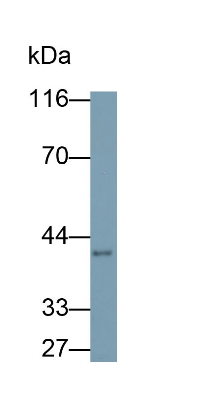 Polyclonal Antibody to Dickkopf Related Protein 3 (DKK3)