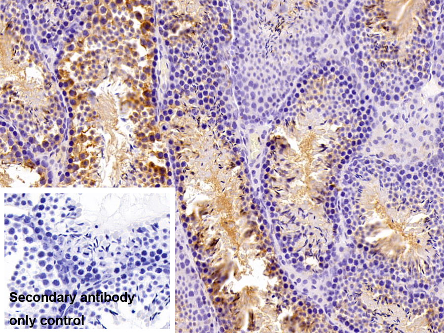 Polyclonal Antibody to Dickkopf Related Protein 3 (DKK3)