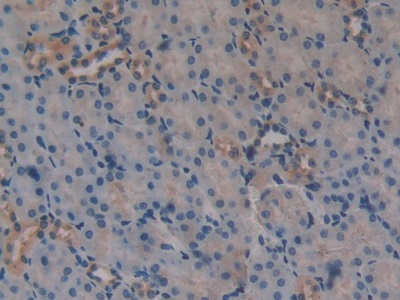 Polyclonal Antibody to Dickkopf Related Protein 3 (DKK3)