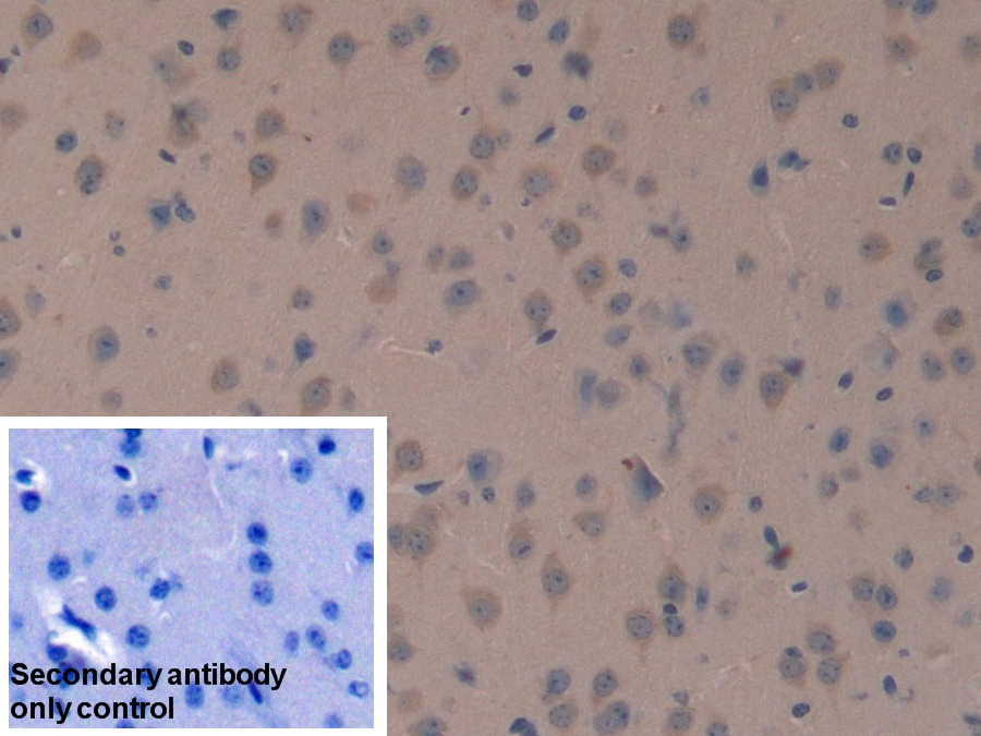 Polyclonal Antibody to Dickkopf Related Protein 3 (DKK3)