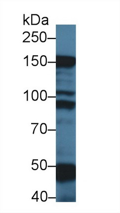 Polyclonal Antibody to Myosin Binding Protein C, Slow Type (MYBPC1)