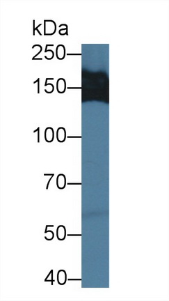 Polyclonal Antibody to Myosin Binding Protein C, Slow Type (MYBPC1)