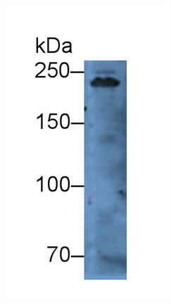 Polyclonal Antibody to Myosin Heavy Chain 7, Cardiac Muscle, Beta (MYH7)