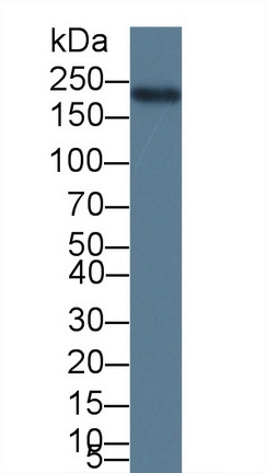 Polyclonal Antibody to Myosin Heavy Chain 6, Cardiac Muscle, Alpha (MYH6)