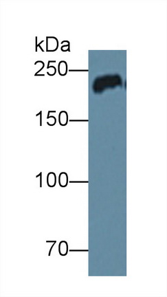 Polyclonal Antibody to Myosin Heavy Chain 6, Cardiac Muscle, Alpha (MYH6)