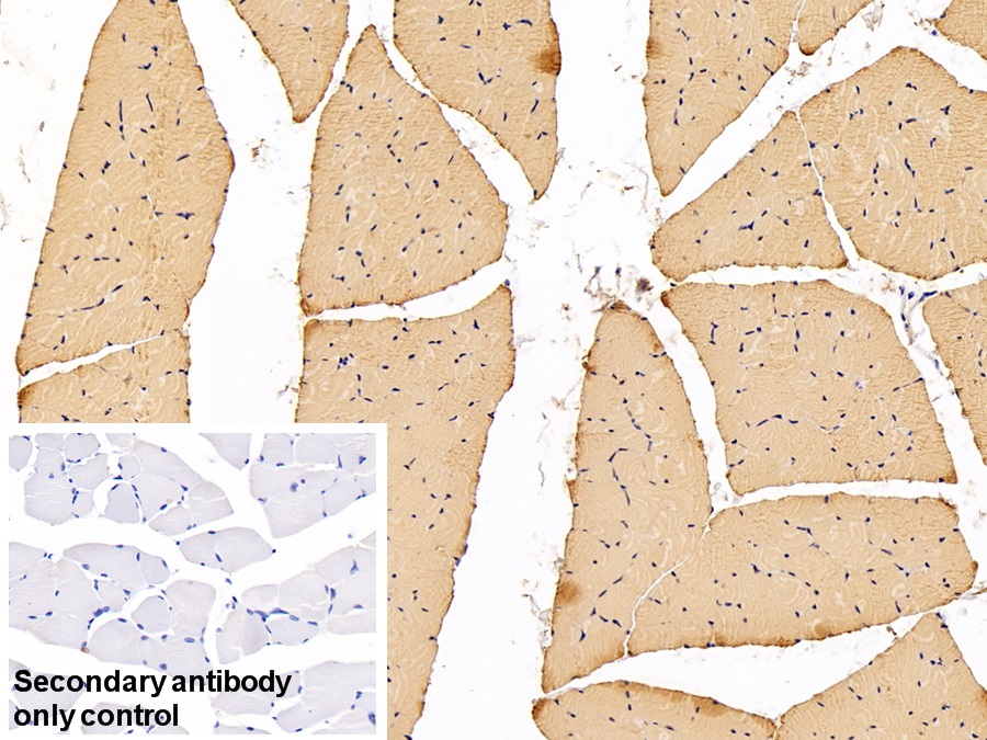 Polyclonal Antibody to Myosin Heavy Chain 6, Cardiac Muscle, Alpha (MYH6)