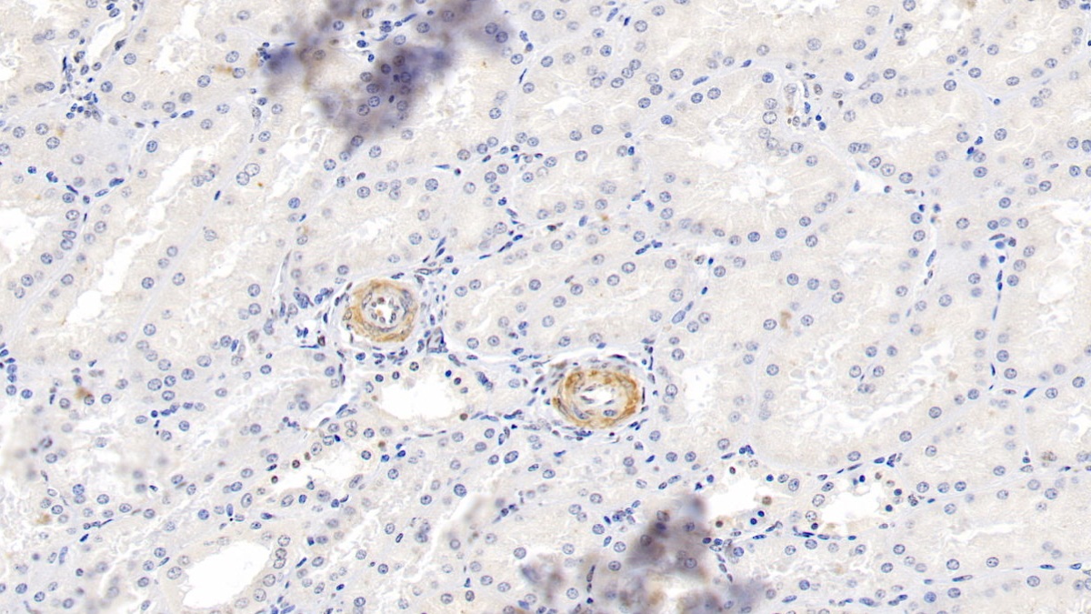 Polyclonal Antibody to Myosin Heavy Chain 11, Smooth Muscle (MYH11)