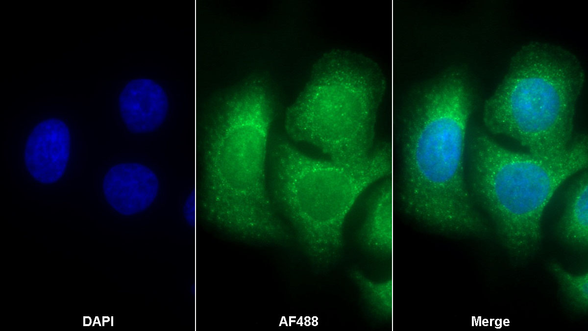 Polyclonal Antibody to Myosin Heavy Chain 11, Smooth Muscle (MYH11)