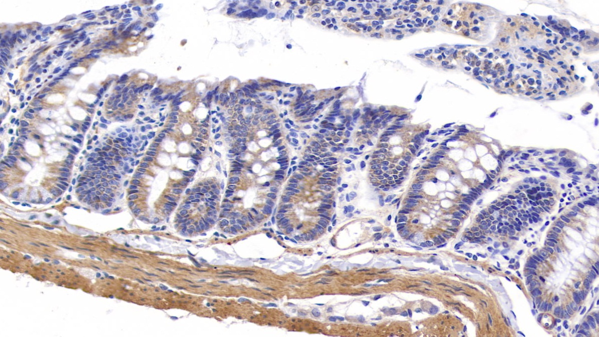 Polyclonal Antibody to Myosin Heavy Chain 11, Smooth Muscle (MYH11)