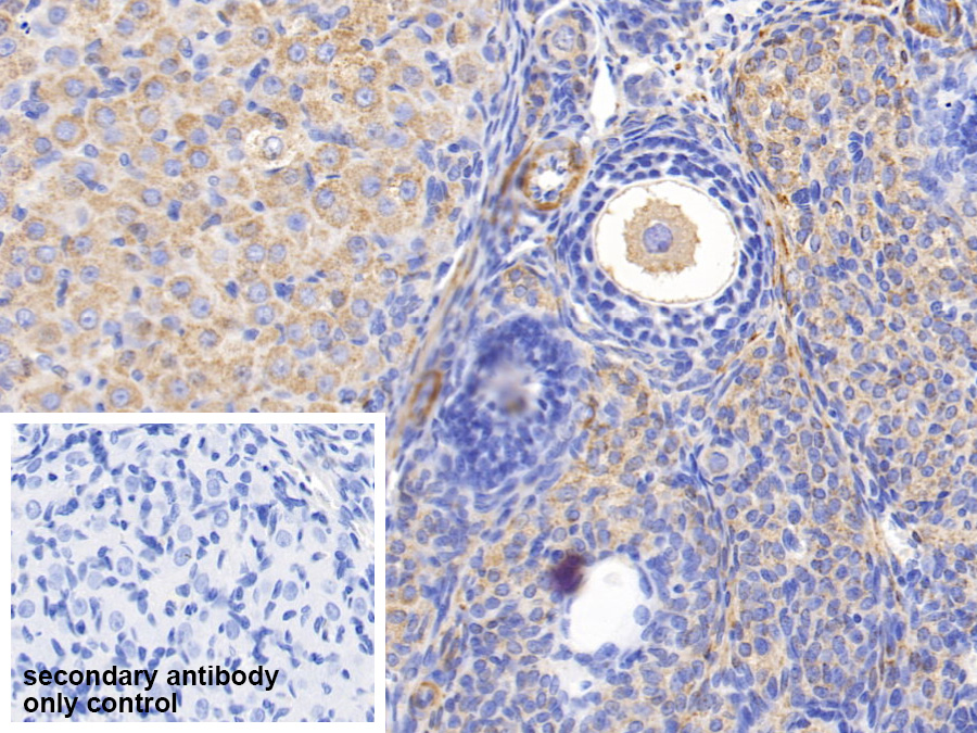 Polyclonal Antibody to Myosin Heavy Chain 11, Smooth Muscle (MYH11)