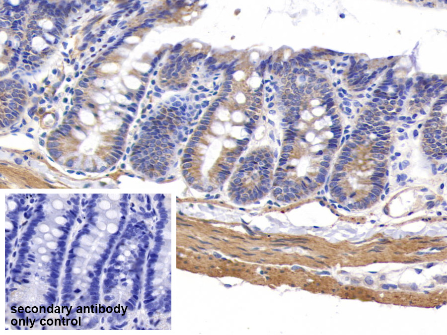 Polyclonal Antibody to Myosin Heavy Chain 11, Smooth Muscle (MYH11)