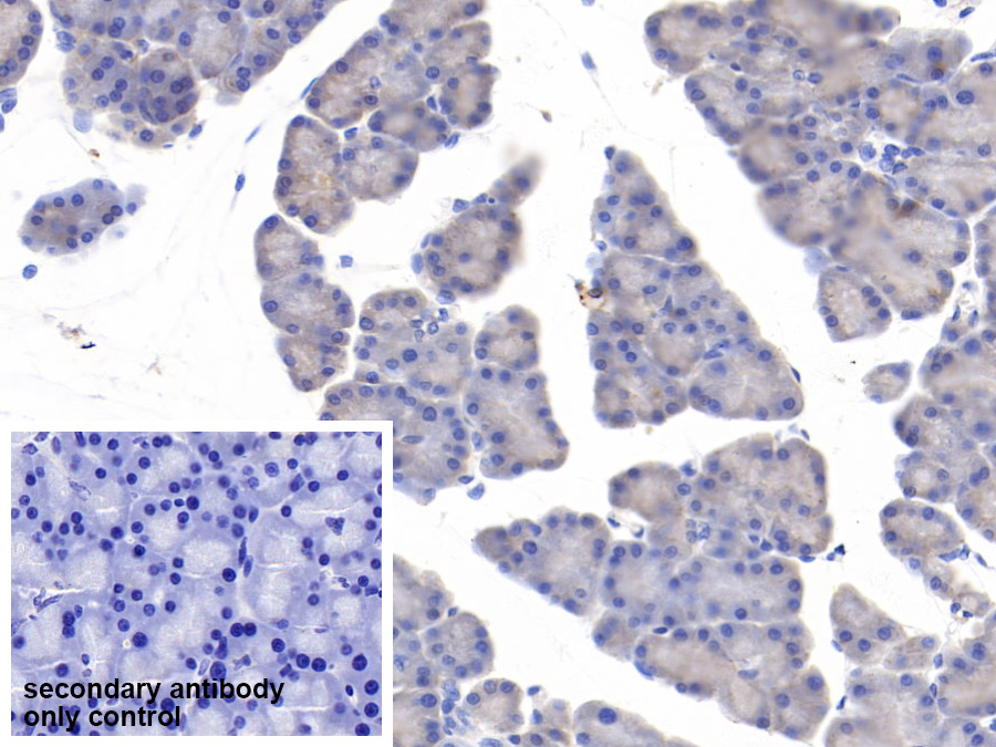 Polyclonal Antibody to Myosin Heavy Chain 11, Smooth Muscle (MYH11)