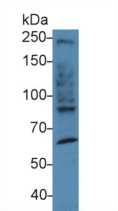 Polyclonal Antibody to Myosin Heavy Chain 10, Non Muscle (MYH10)