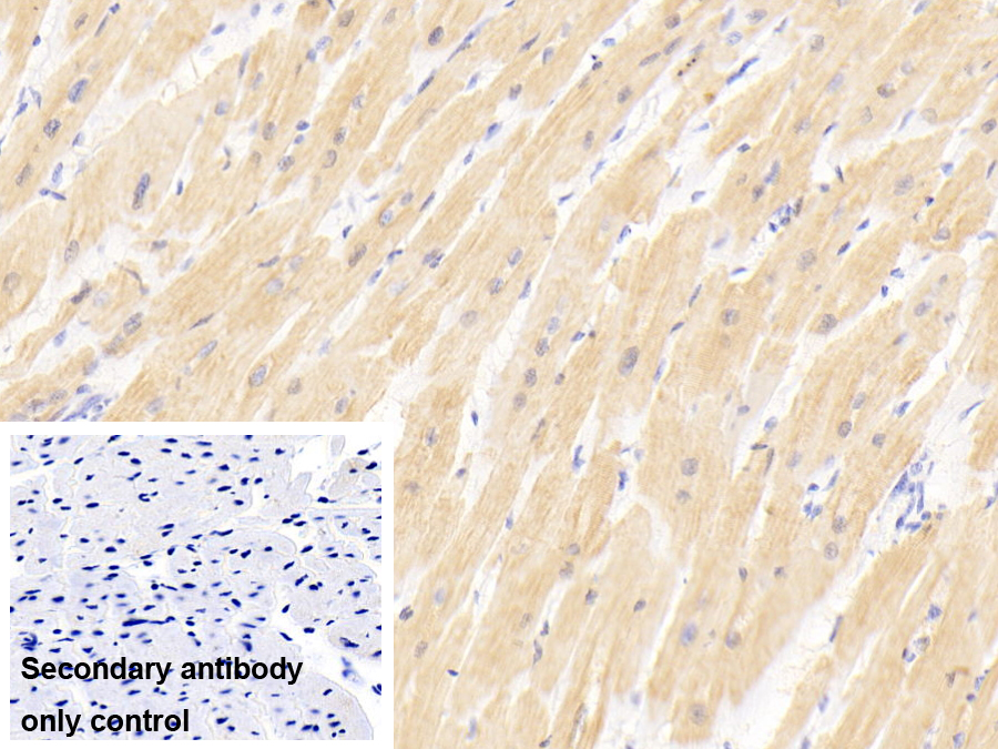 Polyclonal Antibody to Myosin Light Chain 3, Alkali, Ventricular, Slow Skeletal (MYL3)