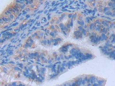 Polyclonal Antibody to Myosin Light Chain Kinase 2 (MYLK2)