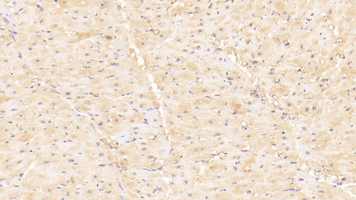 Polyclonal Antibody to Myosin Light Chain Kinase 3 (MYLK3)