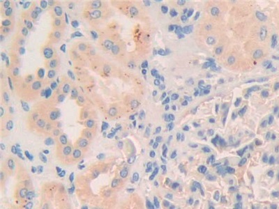 Polyclonal Antibody to Myosin IC (MYO1C)