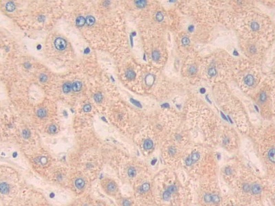 Polyclonal Antibody to Myosin IC (MYO1C)