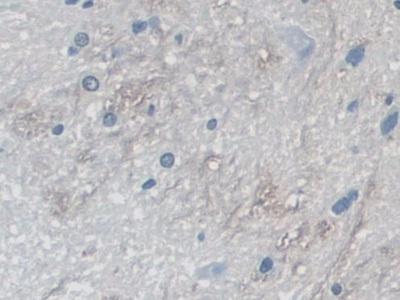 Polyclonal Antibody to Myosin ID (MYO1D)