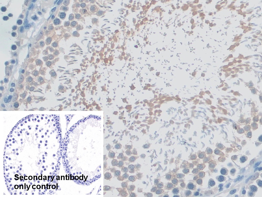 Polyclonal Antibody to Myosin ID (MYO1D)