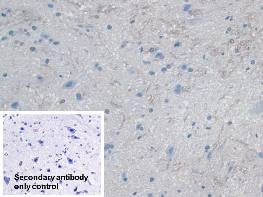 Polyclonal Antibody to Myosin ID (MYO1D)