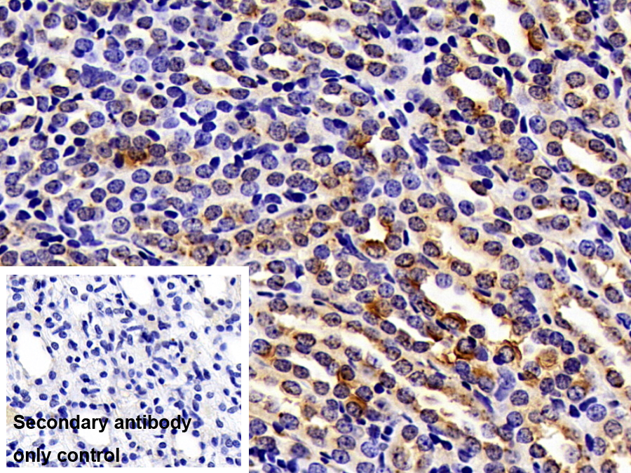 Polyclonal Antibody to Myosin IE (MYO1E)